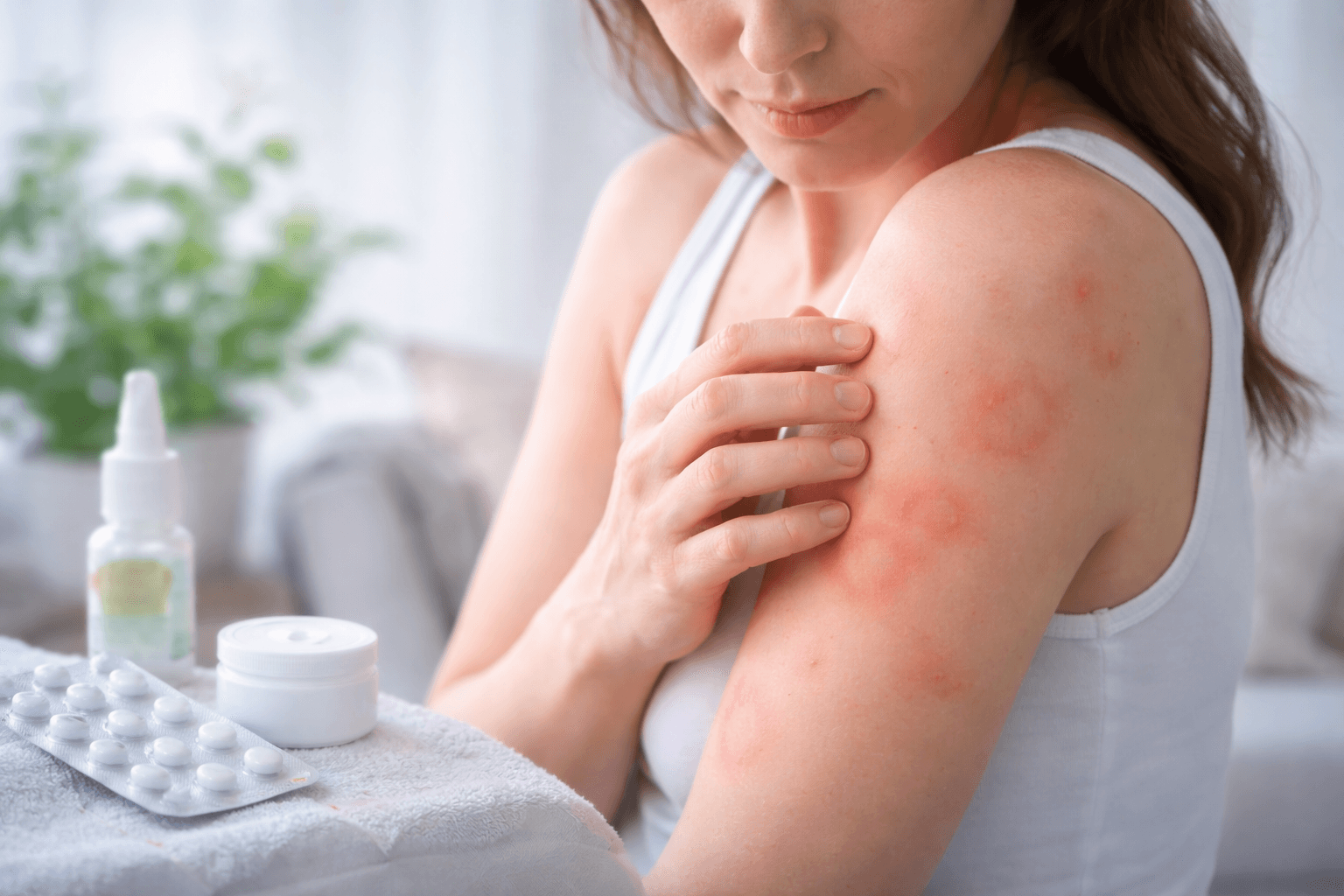 How Long Does a Hive Rash Last?